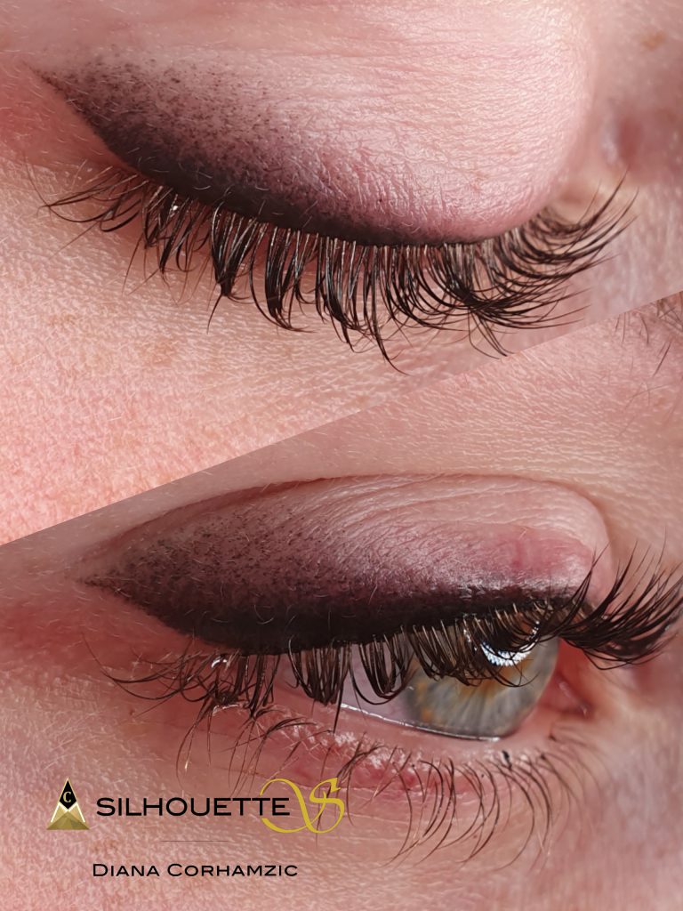 Wimpernkranzverdichtung und Lidstrich